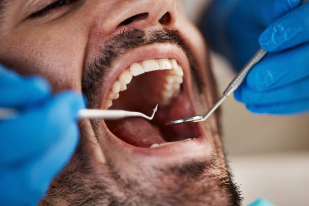Best Emergency Dental Surgery in Saint Johns University, MN